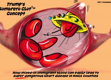 Trump clot